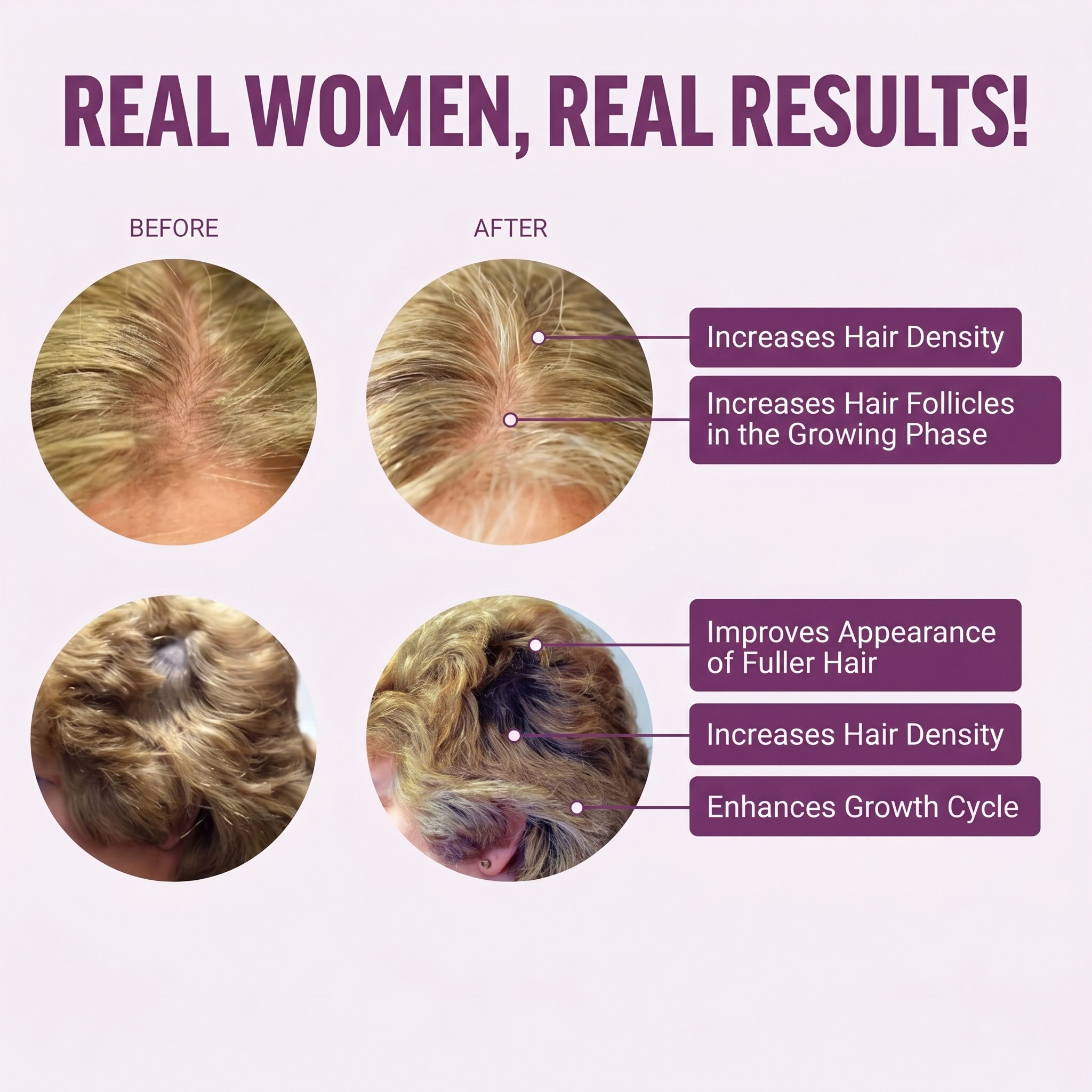 Gomitas para el Cabello – Anticaída desde Adentro